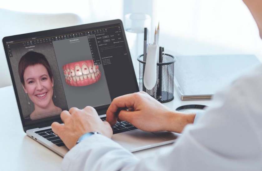 AI có thể giúp bác sĩ dự đoán chuyển động răng trong chỉnh nha