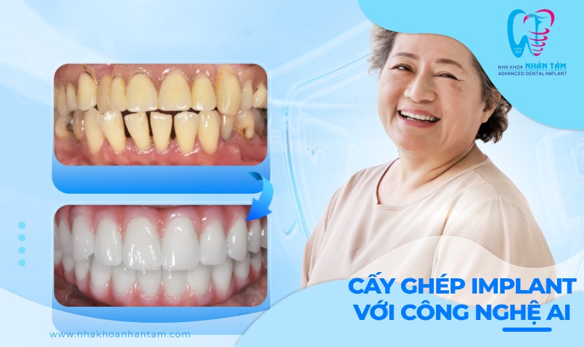 Vượt qua nỗi sợ khi cấy ghép Implant nhờ công nghệ AI
