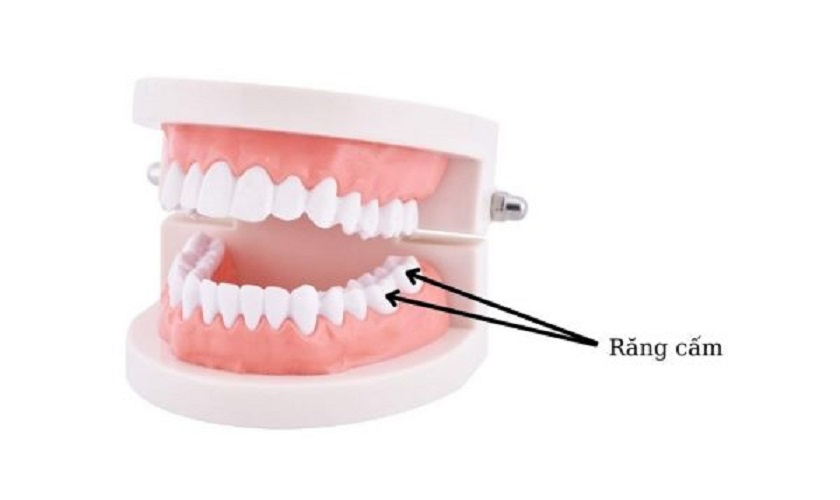 Răng cấm là các răng số 6 và 7 trên cung hàm