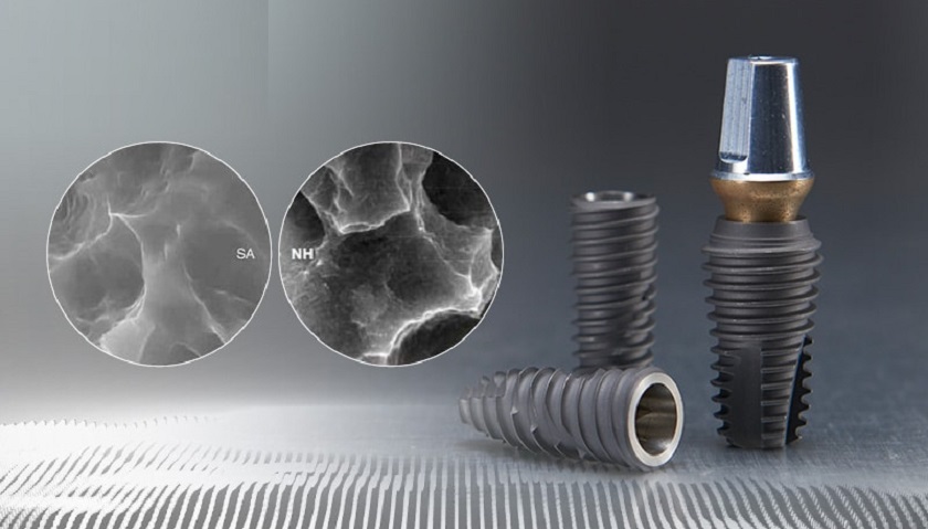 Trụ Implant Mỹ với chất lượng vượt trội