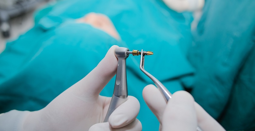 Phẫu thuật đặt trụ Implant vào xương hàm thường diễn ra trong khoảng 15-30 phút