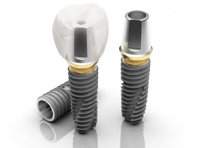 Vật liệu cấy ghép là yếu tố góp phần tạo nên sự khác biệt về giá cả