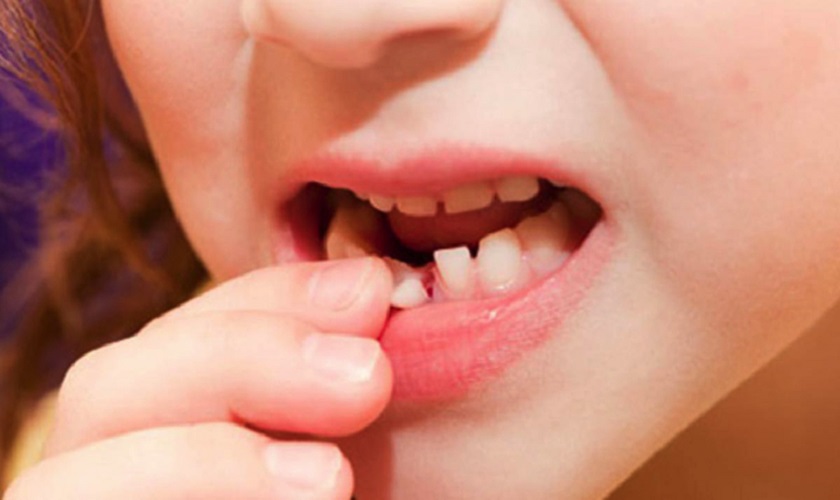 Quy trình nhổ răng khôn như thế nào?
