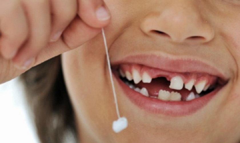 Tự nhổ răng: “Ý tưởng” hay nhưng nguy hiểm khôn lường