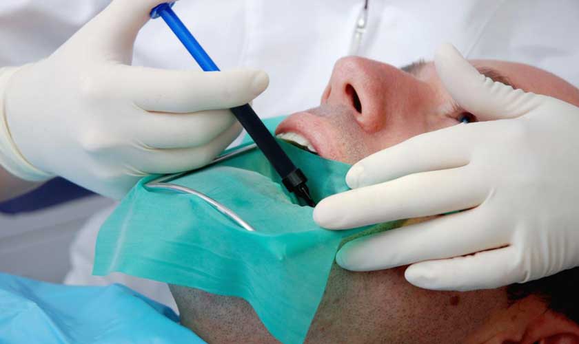 Gây tê cục bộ trước khi điều trị tủy