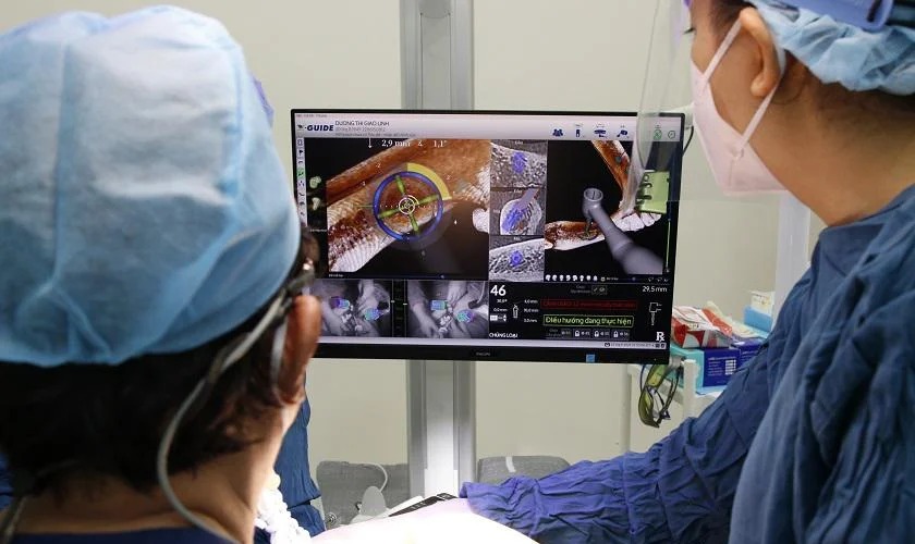 Công nghệ định vị X-Guide hiển thị rõ hướng đi của mũi khoang