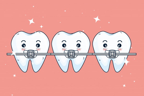 Ưu điểm của niềng răng theo từng phương pháp