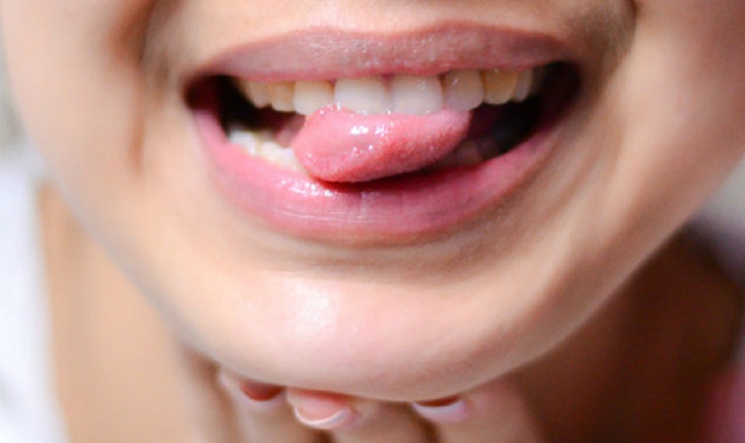 Nhai trầu quá nhiều sẽ khiến lưỡi bị tê rát