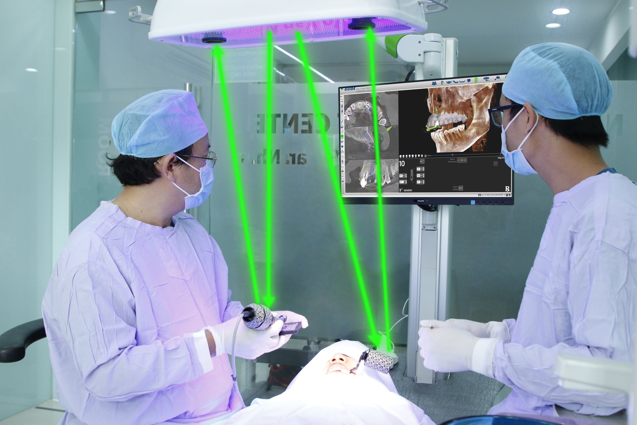 Nha khoa Nhân Tâm ứng dụng công nghệ định vị trong cấy ghép Implant