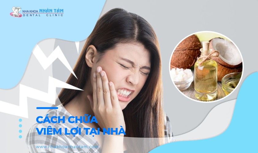 Hình: 10 cách chữa viêm lợi tại nhà hiệu quả nhanh nhất