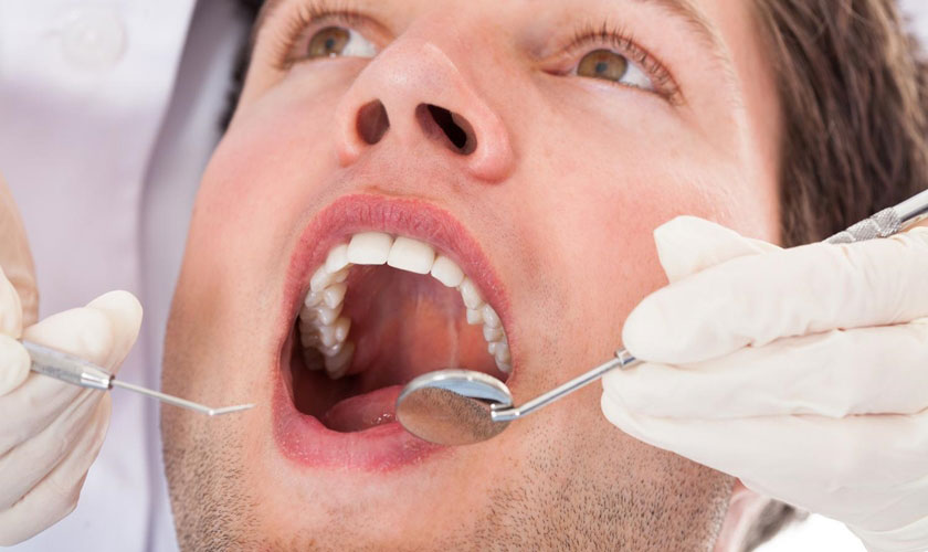 Tiểu đường là yếu tố nguy cơ của bệnh nha chu