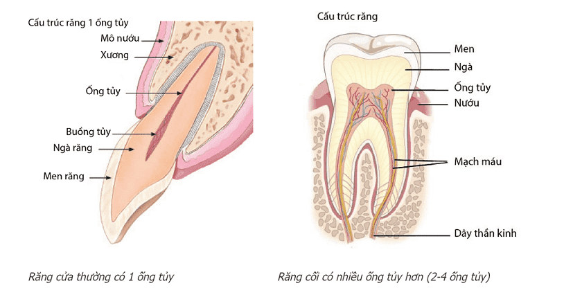 Điều trị tủy răng  Nha Khoa Thúy Đức
