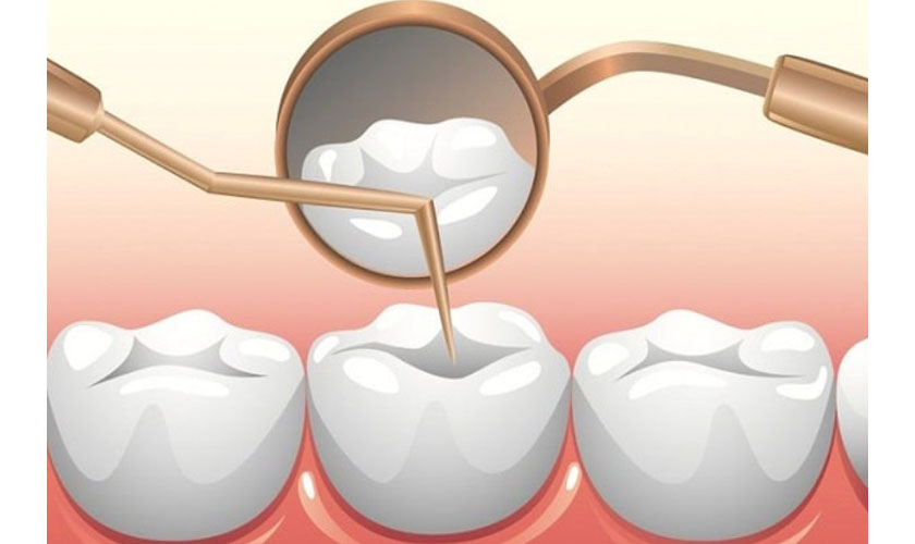 Điều trị tủy răng không đau