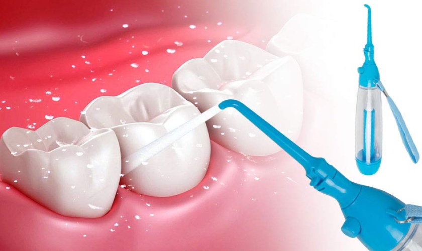 Nên lấy cao răng định kỳ 6 tháng/lần