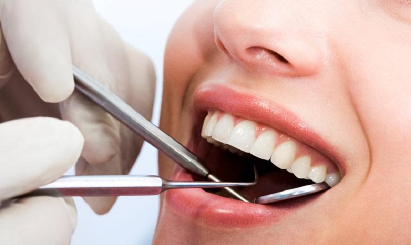 Giá cạo vôi răng  bao nhiêu tiền?