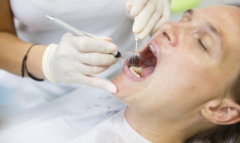 Nên thực hiện cạo vôi răng theo định kỳ hoặc theo chỉ định của bác sĩ Nên thực hiện cạo vôi răng theo định kỳ hoặc theo chỉ định của bác sĩ