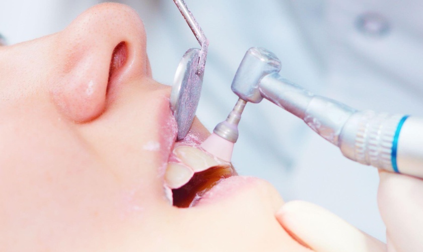 Đâu là nha khoa cạo vôi răng an toàn và hiệu quả?